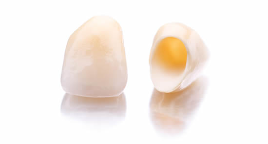 Dental crown